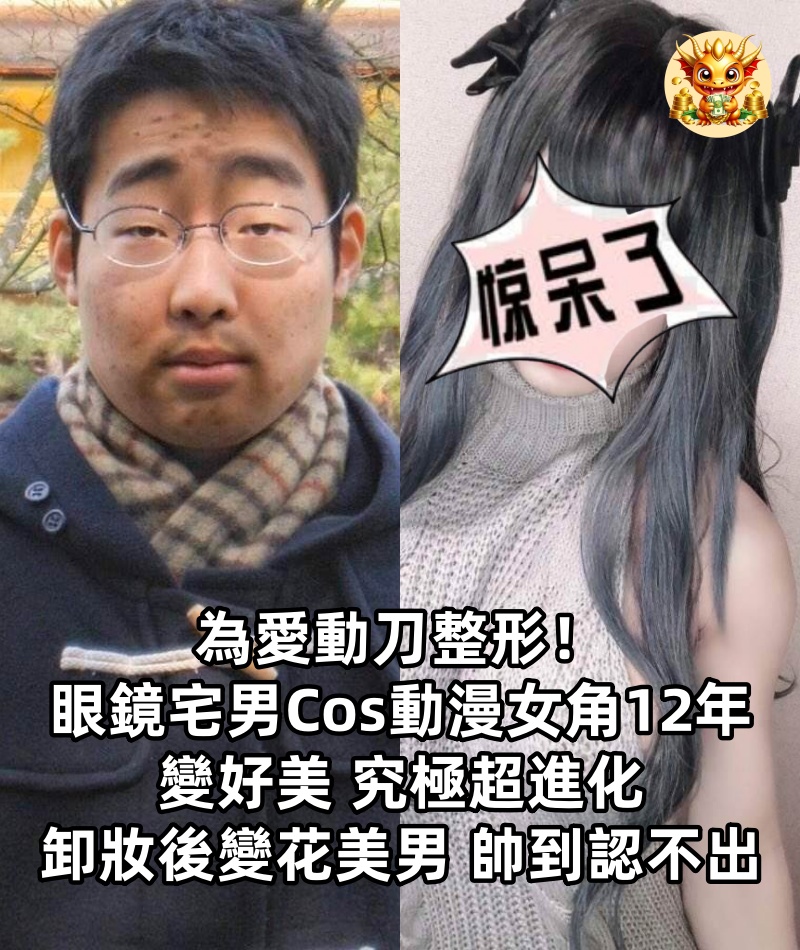 為愛動刀整形！眼鏡宅男「Cos動漫女角12年」變好美 究極超進化「卸妝後變花美男」帥到認不出